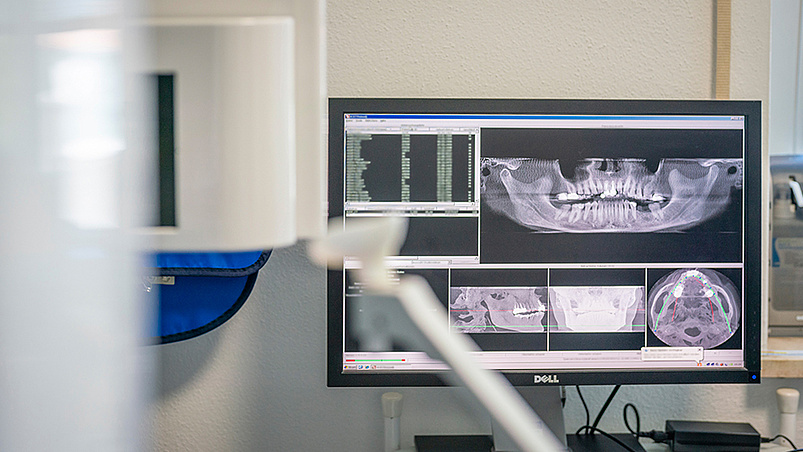 Wurzelbehandlung (Endodontie)